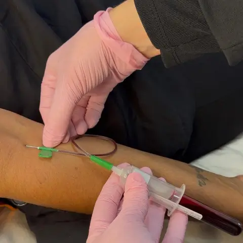 i-PRF-PRF-Alb-Gel-coleta-sangue
