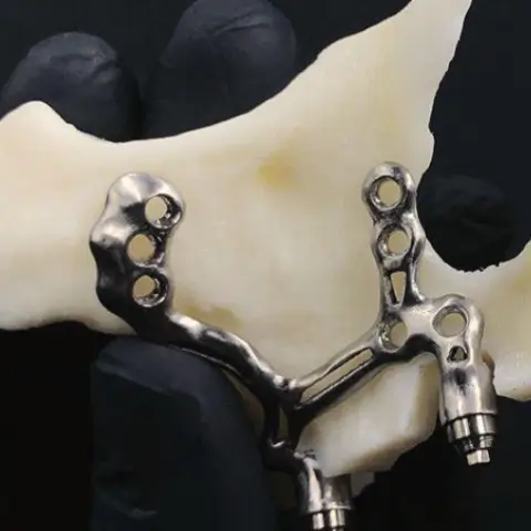 implantes odontológico fernanda pirossi